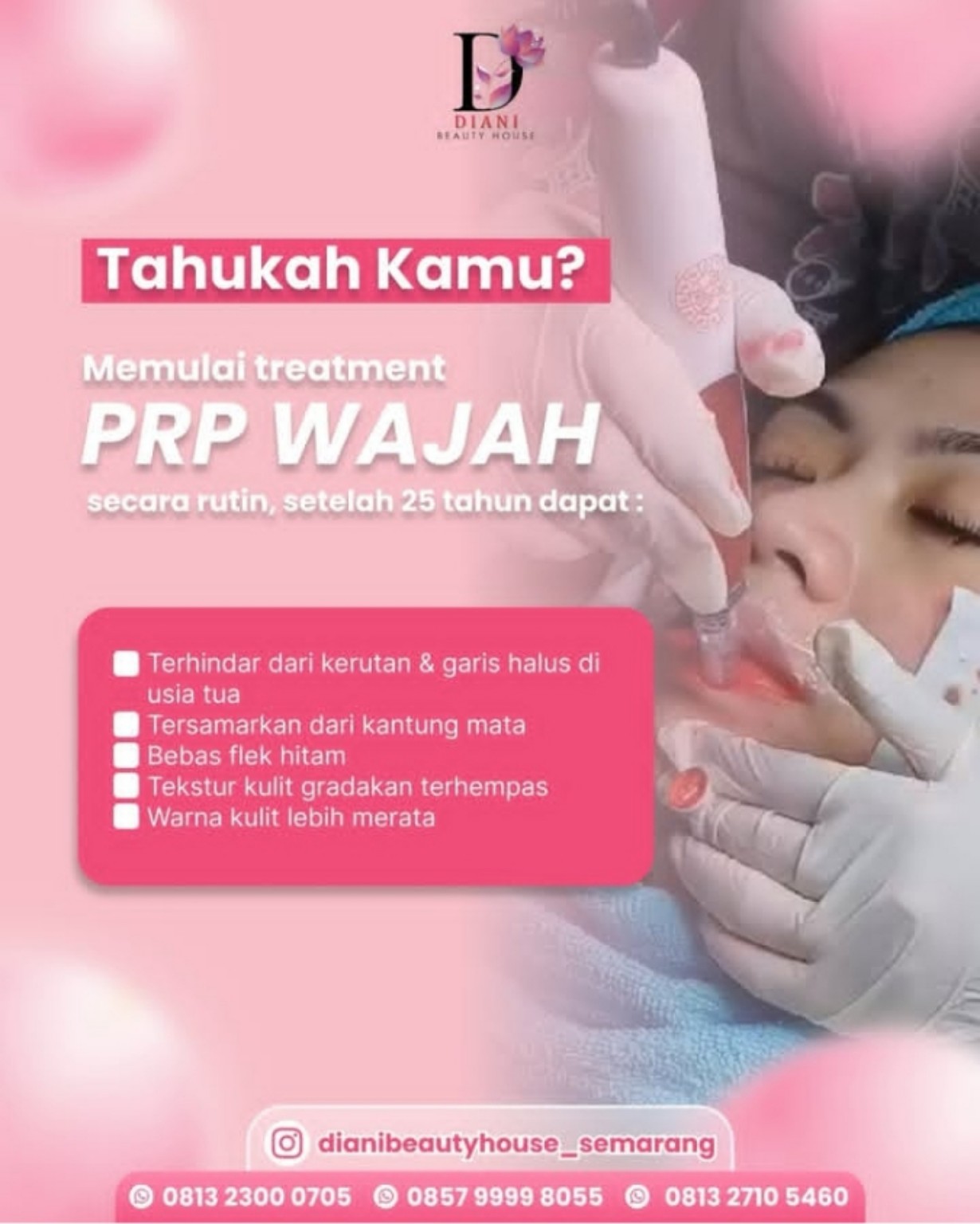 PRP Wajah